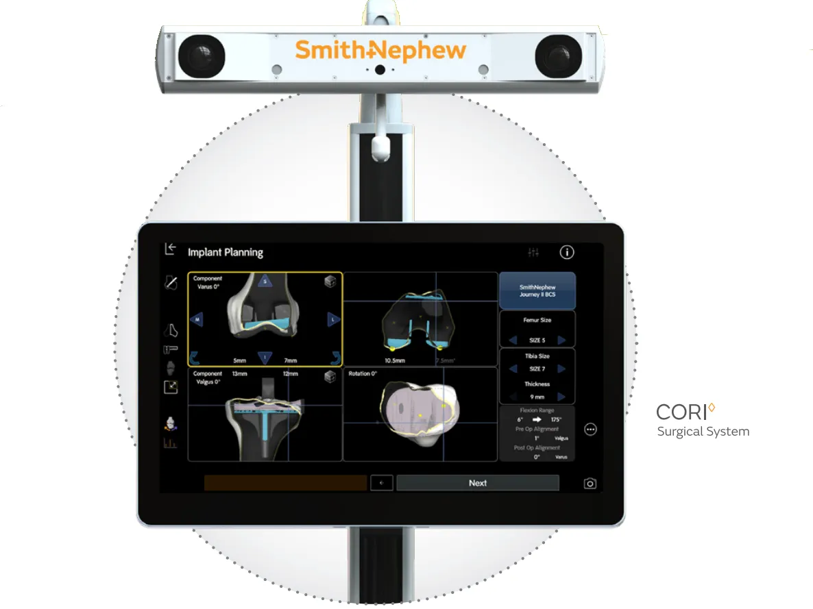 Smith & Nephew CORI Surgical System for knee replacement